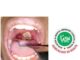Diphtheria: AMLSN issues red alert to Medical Lab. Scientists